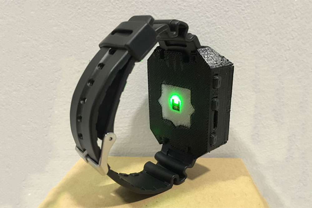 SPO2-Monitoring-System With AI