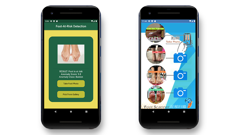 Detect diabetic foot