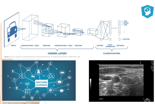 1-SKW-0089-ThyroidNoduleClassification