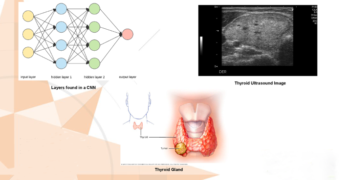 1-SKW-Sem2-ThyroidNoduleClassification